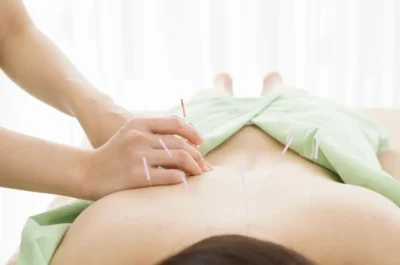woman lying on her stomach with accupuncture needles on her back