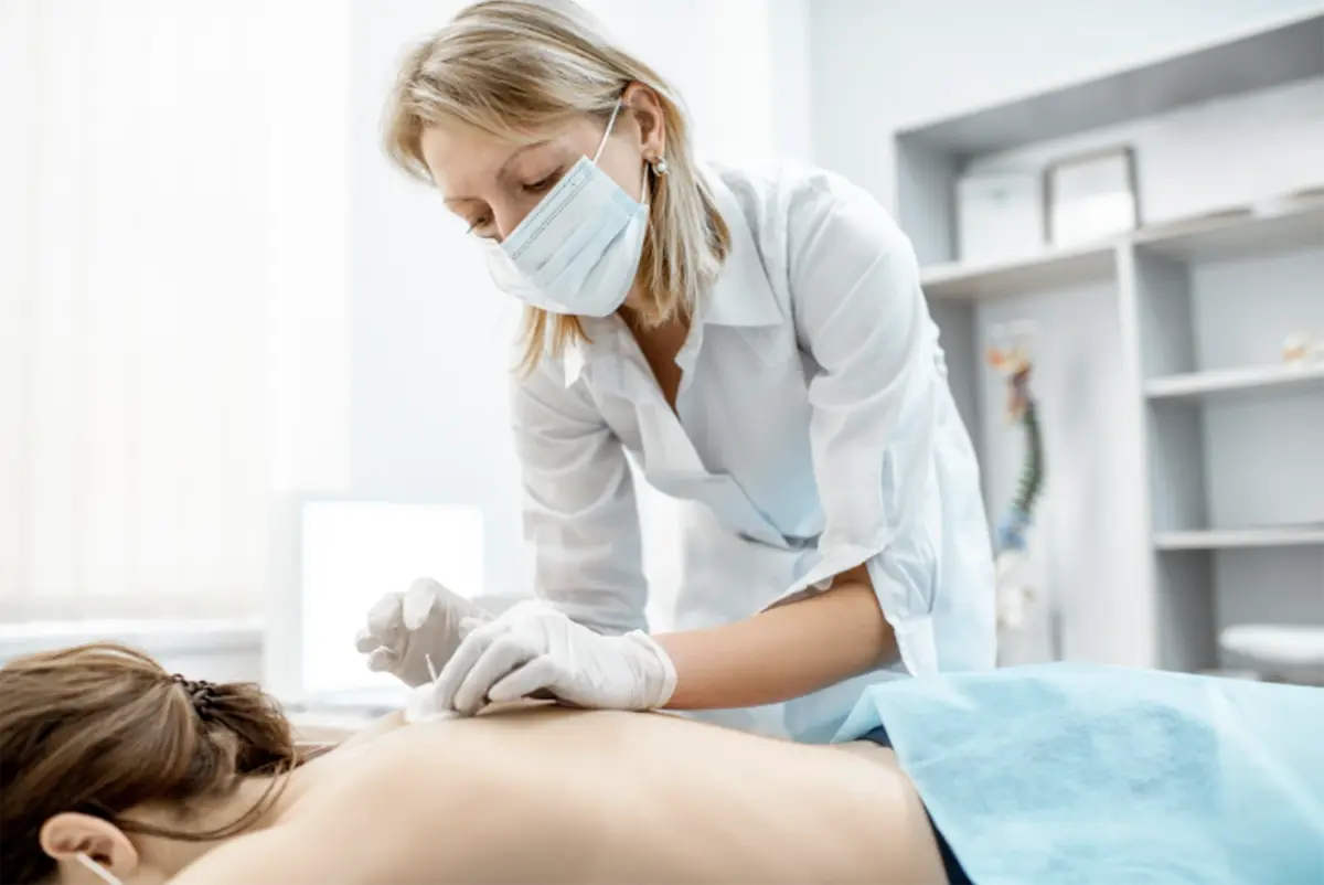 Acupuncture doctor placing needles on patient's back